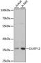 Dual Specificity Phosphatase 12 antibody, LS-C748307, Lifespan Biosciences, Western Blot image 