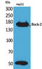 Rho Associated Coiled-Coil Containing Protein Kinase 2 antibody, STJ96558, St John