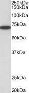 Serine/Threonine Kinase 3 antibody, 42-982, ProSci, Western Blot image 