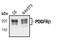 Platelet Derived Growth Factor Receptor Beta antibody, MA5-15143, Invitrogen Antibodies, Western Blot image 