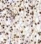 Pleckstrin Homology Domain Interacting Protein antibody, FNab06390, FineTest, Immunohistochemistry frozen image 