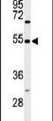 Gastrin Releasing Peptide Receptor antibody, PA5-26791, Invitrogen Antibodies, Western Blot image 