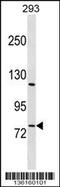 RB Associated KRAB Zinc Finger antibody, 58-617, ProSci, Western Blot image 