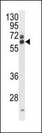 Eukaryotic Translation Initiation Factor 3 Subunit L antibody, LS-C157709, Lifespan Biosciences, Western Blot image 