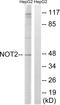 CCR4-NOT Transcription Complex Subunit 2 antibody, A06400-1, Boster Biological Technology, Western Blot image 