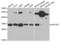 Hepatitis A Virus Cellular Receptor 2 antibody, abx001957, Abbexa, Western Blot image 