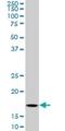 Basic Leucine Zipper ATF-Like Transcription Factor antibody, H00010538-M01, Novus Biologicals, Western Blot image 