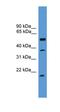 Serine Peptidase Inhibitor, Kunitz Type 2 antibody, orb331021, Biorbyt, Western Blot image 
