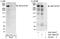 Zinc Finger Protein 318 antibody, A301-546A, Bethyl Labs, Immunoprecipitation image 