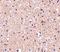 Stathmin 1 antibody, NBP1-76798, Novus Biologicals, Immunohistochemistry paraffin image 