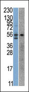 Serine/threonine-protein kinase 38 antibody, AP13643PU-N, Origene, Western Blot image 