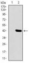 Delta Like Canonical Notch Ligand 4 antibody, GTX60617, GeneTex, Western Blot image 