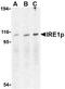 Serine/threonine-protein kinase/endoribonuclease IRE1 antibody, TA306273, Origene, Western Blot image 