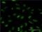 Eukaryotic Translation Initiation Factor 4E Binding Protein 1 antibody, LS-C197119, Lifespan Biosciences, Immunofluorescence image 