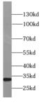 C-Type Lectin Domain Containing 10A antibody, FNab01745, FineTest, Western Blot image 