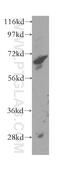 Acyl-CoA Dehydrogenase Family Member 9 antibody, 15770-1-AP, Proteintech Group, Western Blot image 