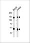 Nuclear Factor Kappa B Subunit 1 antibody, M00283-2, Boster Biological Technology, Western Blot image 
