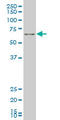 Forkhead Box O1 antibody, LS-C104951, Lifespan Biosciences, Western Blot image 