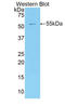 Sphingomyelin Phosphodiesterase 2 antibody, LS-C303836, Lifespan Biosciences, Western Blot image 