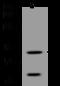 Furin, Paired Basic Amino Acid Cleaving Enzyme antibody, 310451-T32, Sino Biological, Western Blot image 