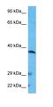 Electron transfer flavoprotein subunit alpha, mitochondrial antibody, orb330741, Biorbyt, Western Blot image 