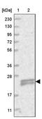 TMEM9 Domain Family Member B antibody, PA5-58103, Invitrogen Antibodies, Western Blot image 