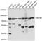 ATP Binding Cassette Subfamily B Member 8 antibody, GTX64900, GeneTex, Western Blot image 