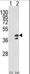 Glutamic-Oxaloacetic Transaminase 1 antibody, LS-C166583, Lifespan Biosciences, Western Blot image 