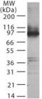 Toll Like Receptor 2 antibody, GTX12118, GeneTex, Western Blot image 