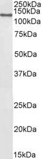 Serpin Family F Member 1 antibody, 43-619, ProSci, Enzyme Linked Immunosorbent Assay image 