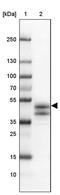 Acrosomal Vesicle Protein 1 antibody, PA5-58511, Invitrogen Antibodies, Western Blot image 