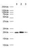 Caveolin 1 antibody, ab2910, Abcam, Western Blot image 