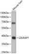 Low Density Lipoprotein Receptor Adaptor Protein 1 antibody, A7093, ABclonal Technology, Western Blot image 