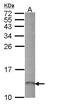 Receptor Activity Modifying Protein 1 antibody, PA5-21954, Invitrogen Antibodies, Western Blot image 