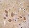 Adaptor Related Protein Complex 1 Subunit Mu 1 antibody, LS-C156382, Lifespan Biosciences, Immunohistochemistry paraffin image 