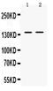 Transient Receptor Potential Cation Channel Subfamily M Member 4 antibody, PB9902, Boster Biological Technology, Western Blot image 