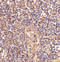 ATM Serine/Threonine Kinase antibody, 3945, ProSci, Immunohistochemistry paraffin image 