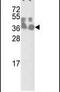 Chloride Nucleotide-Sensitive Channel 1A antibody, PA5-13450, Invitrogen Antibodies, Western Blot image 
