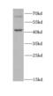 Dyskerin Pseudouridine Synthase 1 antibody, FNab02400, FineTest, Western Blot image 