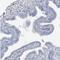 Zinc Finger CCHC-Type Containing 12 antibody, NBP1-83675, Novus Biologicals, Immunohistochemistry frozen image 