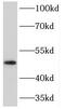 Protein Kinase CAMP-Dependent Type I Regulatory Subunit Beta antibody, FNab06780, FineTest, Western Blot image 