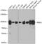 Ribonucleotide Reductase Catalytic Subunit M1 antibody, GTX54666, GeneTex, Western Blot image 