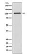 Inositol Polyphosphate-4-Phosphatase Type II B antibody, M06336, Boster Biological Technology, Western Blot image 