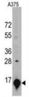 Galectin 1 antibody, NBP2-11500, Novus Biologicals, Western Blot image 