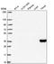 Interferon Gamma Receptor 1 antibody, NBP2-49406, Novus Biologicals, Western Blot image 