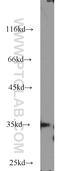 THO Complex 6 antibody, 15316-1-AP, Proteintech Group, Western Blot image 