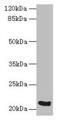 Signal Peptidase Complex Subunit 3 antibody, CSB-PA022517LA01HU, Cusabio, Western Blot image 