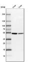 Cytochrome P450 Family 2 Subfamily E Member 1 antibody, NBP1-85367, Novus Biologicals, Western Blot image 