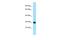 Leucine-rich repeat-containing protein 10 antibody, A15338, Boster Biological Technology, Western Blot image 