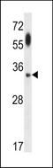 Autophagy Related 5 antibody, TA324634, Origene, Western Blot image 